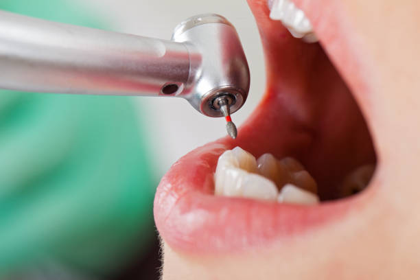 Best Tooth Pain Emergency Relief  in New Carrollton, MD